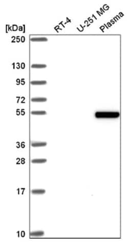 ZGPAT Antibody, Novus Biologicals:Antibodies:Primary Antibodies