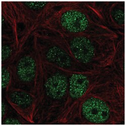 ZHX1 Antibody, Novus Biologicals 100&mu;L; Unlabeled:Antibodies, Polyclonal