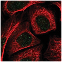 Zic2 Antibody, Novus Biologicals 100&mu;L; Unlabeled:Antibodies, Polyclonal
