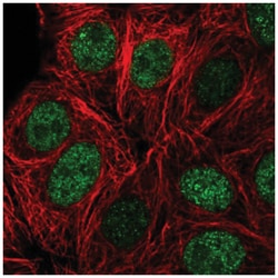 Zinc Finger And BTB Domain Containing 42 Antibody, Novus Biologicals 25 &mu;L | Buy Online | Novus Biologicals | Fisher Scientific