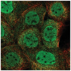 ZMYM4 Antibody, Novus Biologicals 25 &mu;L, Unlabeled:Antibodies, Polyclonal