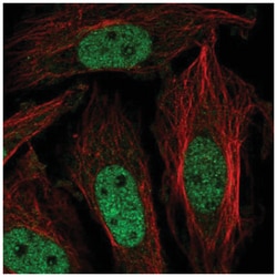 ZNF131 Antibody, Novus Biologicals:Antibodies:Primary Antibodies