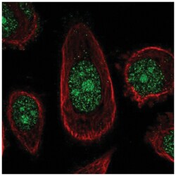 ZNF16 Antibody, Novus Biologicals:Antibodies:Primary Antibodies