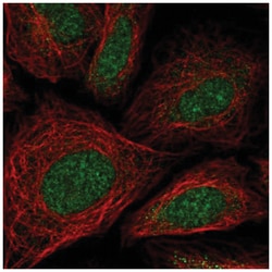 ZNF181 Antibody, Novus Biologicals 25 &mu;L, Unlabeled:Antibodies, Polyclonal