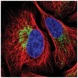 ZNF211 Antibody, Novus Biologicals 25 &mu;L, Unlabeled:Antibodies, Polyclonal