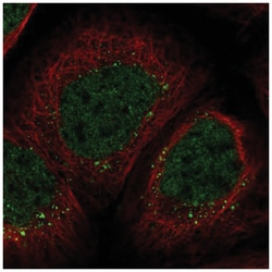 ZNF213 Antibody, Novus Biologicals:Antibodies:Primary Antibodies