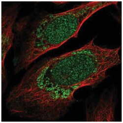 ZNF223 Antibody, Novus Biologicals 25 &mu;L, Unlabeled:Antibodies, Polyclonal