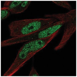 ZNF225 Antibody, Novus Biologicals 25 &mu;L, Unlabeled:Antibodies, Polyclonal