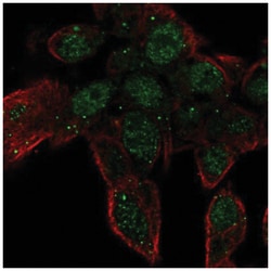 ZNF232 Antibody, Novus Biologicals 100&mu;L; Unlabeled:Antibodies, Polyclonal
