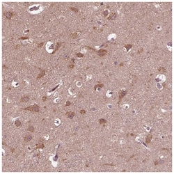 ZNF292 Antibody, Novus Biologicals:Antibodies:Primary Antibodies