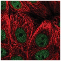 ZNF295 Antibody, Novus Biologicals:Antibodies:Primary Antibodies