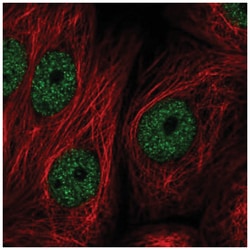 ZNF295 Antibody, Novus Biologicals:Antibodies:Primary Antibodies
