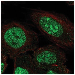 ZNF300 Antibody, Novus Biologicals 100 &mu;L | Buy Online | Novus Biologicals | Fisher Scientific