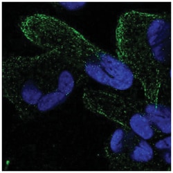 ZNF302 Antibody, Novus Biologicals 100&mu;L; Unlabeled:Antibodies, Polyclonal