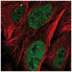 ZNF32 Antibody, Novus Biologicals 25 &mu;L:Antibodies, Polyclonal