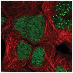 ZNF32 Antibody, Novus Biologicals 25 &mu;L:Antibodies, Polyclonal