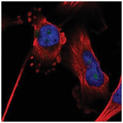 ZNF330 Antibody, Novus Biologicals 25 &mu;L, Unlabeled:Antibodies, Polyclonal