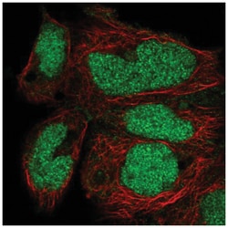 ZNF331 Antibody, Novus Biologicals 100&mu;L; Unlabeled:Antibodies, Polyclonal