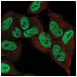 ZNF333 Antibody, Novus Biologicals 25 &mu;L:Antibodies, Polyclonal