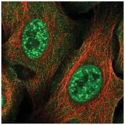 ZNF337 Antibody, Novus Biologicals 100&mu;L; Unlabeled:Antibodies, Polyclonal