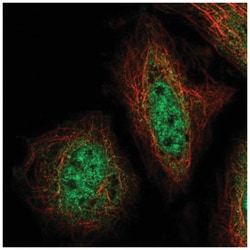 ZNF34 Antibody, Novus Biologicals 25 &mu;L:Antibodies, Polyclonal