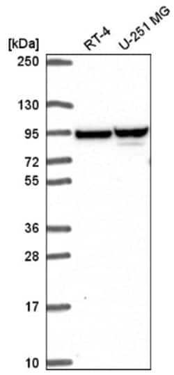 ZNF341 Antibody, Novus Biologicals 25 &mu;L, Unlabeled:Antibodies, Polyclonal