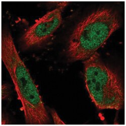 ZNF343 Antibody, Novus Biologicals 100&mu;L; Unlabeled:Antibodies, Polyclonal
