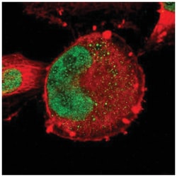ZNF367 Antibody, Novus Biologicals 25 &mu;L, Unlabeled:Antibodies, Polyclonal