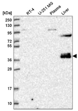 ZNF385B Antibody, Novus Biologicals 100&mu;L; Unlabeled:Antibodies, Polyclonal