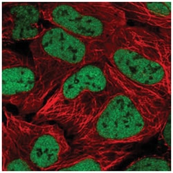 ZNF420 Antibody, Novus Biologicals:Antibodies:Primary Antibodies