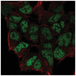 ZNF460 Antibody, Novus Biologicals:Antibodies:Primary Antibodies