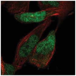 ZNF518 Antibody, Novus Biologicals 25 &mu;L, Unlabeled:Antibodies, Polyclonal