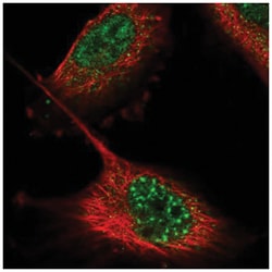 ZNF551 Antibody, Novus Biologicals 100&mu;L; Unlabeled:Antibodies, Polyclonal