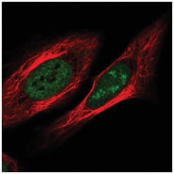 ZNF554 Antibody, Novus Biologicals:Antibodies:Primary Antibodies