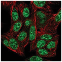 ZNF556 Antibody, Novus Biologicals 100&mu;L; Unlabeled:Antibodies, Polyclonal
