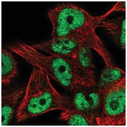 ZNF559 Antibody, Novus Biologicals:Antibodies:Primary Antibodies