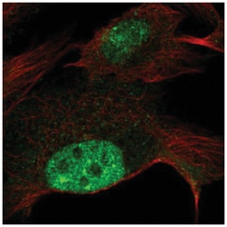 ZNF606 Antibody, Novus Biologicals:Antibodies:Primary Antibodies