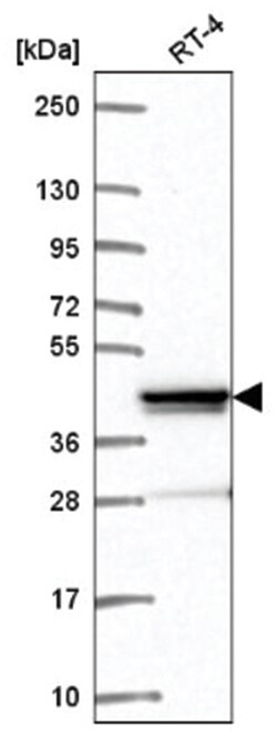 ZNF618 Antibody, Novus Biologicals 25 &mu;L, Unlabeled:Antibodies, Polyclonal