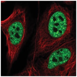 ZNF621 Antibody, Novus Biologicals:Antibodies:Primary Antibodies