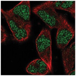 ZNF627 Antibody, Novus Biologicals 100&mu;L; Unlabeled:Antibodies, Polyclonal