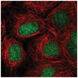 ZNF629 Antibody, Novus Biologicals 25 &mu;L, Unlabeled:Antibodies, Polyclonal