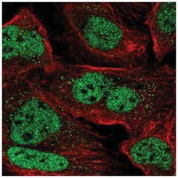 ZNF638 Antibody, Novus Biologicals:Antibodies:Primary Antibodies