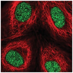 ZNF642 Antibody, Novus Biologicals 100&mu;L; Unlabeled:Antibodies, Polyclonal
