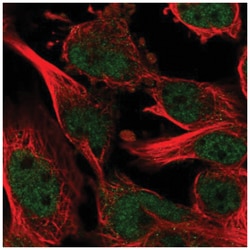 ZNF655 Antibody, Novus Biologicals 100&mu;L; Unlabeled:Antibodies, Polyclonal