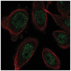 ZNF664 Antibody, Novus Biologicals 25 &mu;L, Unlabeled:Antibodies, Polyclonal