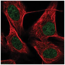 ZNF674 Antibody, Novus Biologicals:Antibodies:Primary Antibodies