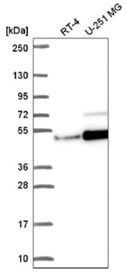 ZNF692 Antibody, Novus Biologicals 25 &mu;L, Unlabeled:Antibodies, Polyclonal