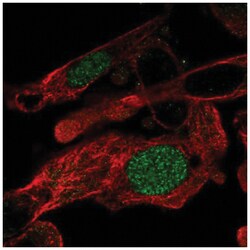 ZNF696 Antibody, Novus Biologicals 25 &mu;L, Unlabeled:Antibodies, Polyclonal
