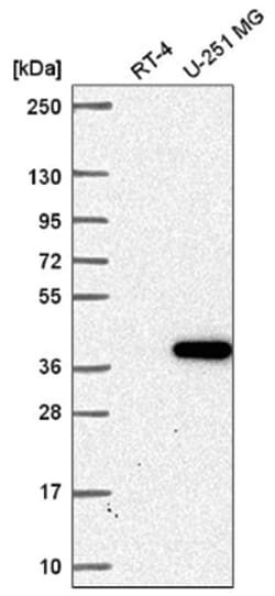 ZNF713 Antibody, Novus Biologicals:Antibodies:Primary Antibodies
