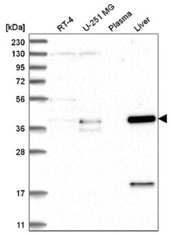 ZNF771 Antibody, Novus Biologicals:Antibodies:Primary Antibodies